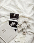 Little Dreamer | Baby Journal | Cloud